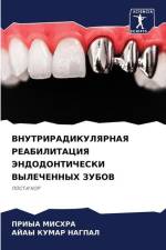 VNUTRIRADIKULYaRNAYa REABILITACIYa JeNDODONTIChESKI VYLEChENNYH ZUBOV af Priya Mishra