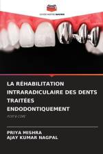 LA RÉHABILITATION INTRARADICULAIRE DES DENTS TRAITÉES ENDODONTIQUEMENT af Priya Mishra