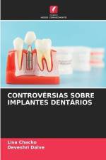 CONTROVÉRSIAS SOBRE IMPLANTES DENTÁRIOS af Lisa Chacko