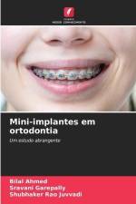 Mini-implantes em ortodontia af Bilal Ahmed