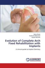 Evolution of Complete Arch Fixed Rehabilitation with Implants af Nazia Afreen