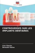 CONTROVERSES SUR LES IMPLANTS DENTAIRES af Lisa Chacko