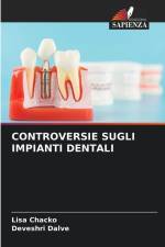 CONTROVERSIE SUGLI IMPIANTI DENTALI af Lisa Chacko