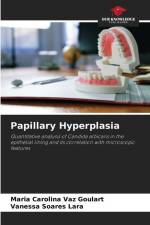 Papillary Hyperplasia af Maria Carolina Vaz Goulart