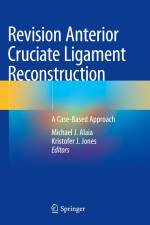 Revision Anterior Cruciate Ligament Reconstruction af Kristofer J. Jones