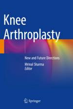 Knee Arthroplasty af Mrinal Sharma