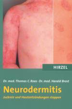 Neurodermitis af Thomas C. Roos