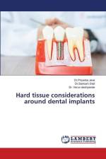 Hard tissue considerations around dental implants af Priyanka Jeve