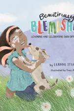 Beautifully Blemished: Learning and Celebrating Skin Differences af Leanne Stuckey