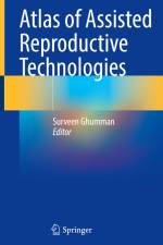 Atlas of Assisted Reproductive Technologies af Surveen Ghumman