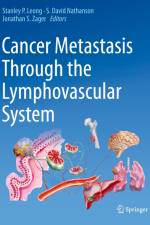 Cancer Metastasis Through the Lymphovascular System af Stanley P. Leong