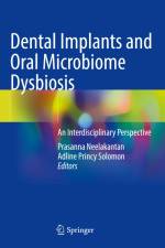 Dental Implants and Oral Microbiome Dysbiosis af Adline Princy Solomon