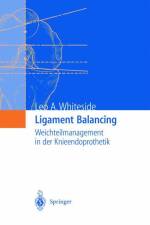 Ligament Balancing af Leo A. Whiteside