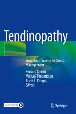 Tendinopathy af Kentaro Onishi