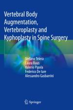 Vertebral Body Augmentation, Vertebroplasty and Kyphoplasty in Spine Surgery af Stefano Telera