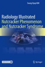 Radiology Illustrated: Nutcracker Phenomenon and Nutcracker Syndrome af Seung Hyup Kim