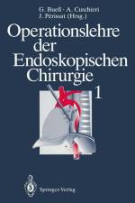Operationslehre der Endoskopischen Chirurgie 1 af Alfred Cuschieri