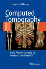 Computed Tomography af Thorsten M. Buzug