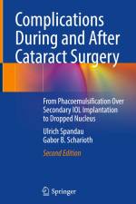 Complications During and After Cataract Surgery af Gabor B. Scharioth