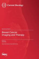 Breast Cancer Imaging and Therapy
