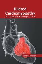 Dilated Cardiomyopathy: An Issue of Cardiology Clinics af Cameron Johnson