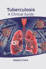 Tuberculosis: A Clinical Guide af Ralphie Clark