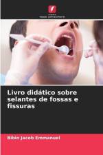 Livro didático sobre selantes de fossas e fissuras af Bibin Jacob Emmanuel