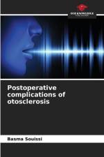Postoperative complications of otosclerosis af Basma Souissi
