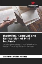Insertion, Removal and Reinsertion of Mini Implants af Evandro Sarubbi Mendes