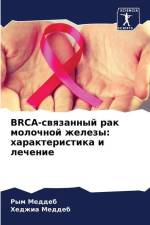 BRCA-swqzannyj rak molochnoj zhelezy: harakteristika i lechenie af Rym Meddeb