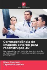 Correspondência de imagens estéreo para reconstrução 3D af Wiem Takrouni
