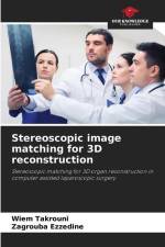 Stereoscopic image matching for 3D reconstruction af Wiem Takrouni