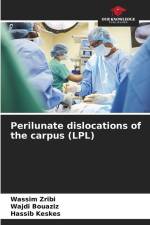 Perilunate dislocations of the carpus (LPL) af Wassim Zribi