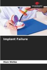 Implant Failure af Hiam Wehbe