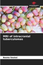 MRI of intracranial tuberculomas af Basma Souissi