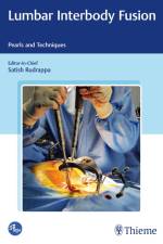 Lumbar Interbody Fusion af Satish Rudrappa