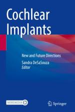 Cochlear Implants af Sandra Desasouza