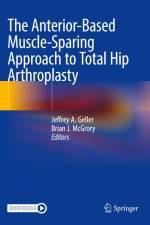 The Anterior-Based Muscle-Sparing Approach to Total Hip Arthroplasty af Brian J. McGrory