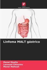 Linfoma MALT gástrico af Manel Moalla