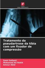 Tratamento da pseudartrose da tíbia com um fixador de compressão af Sami Sellami