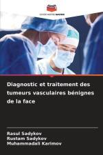 Diagnostic et traitement des tumeurs vasculaires bénignes de la face af Rasul Sadykov