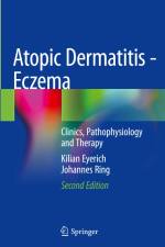 Atopic Dermatitis - Eczema af Johannes Ring