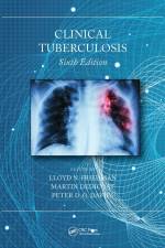Clinical Tuberculosis af Lloyd N. Friedman