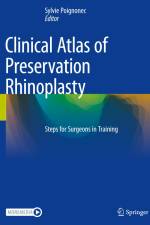 Clinical Atlas of Preservation Rhinoplasty af Sylvie Poignonec