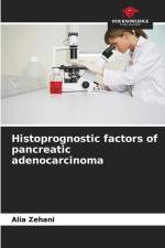 Histoprognostic factors of pancreatic adenocarcinoma af Alia Zehani