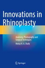 Innovations in Rhinoplasty af Motaz H. A. Shafy