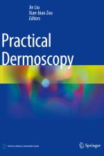 Practical Dermoscopy af Xian-Biao Zou