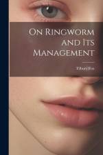 On Ringworm and Its Management af Tilbury Fox