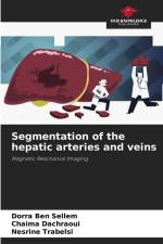 Segmentation of the hepatic arteries and veins af Dorra Ben Sellem
