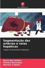 Segmentação das artérias e veias hepáticas af Dorra Ben Sellem